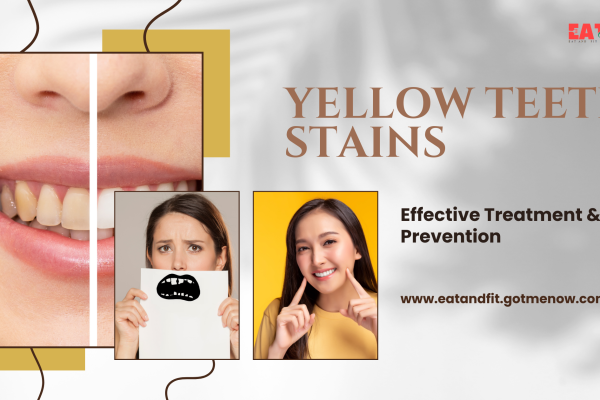 yellow stain in teeth
