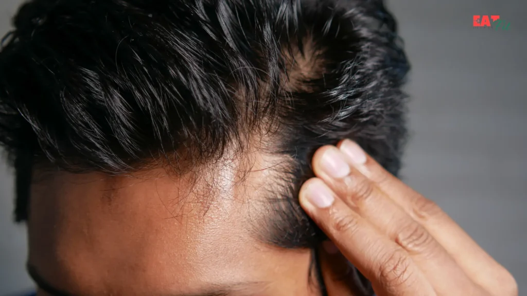 Can Hair Loss Be Reversed?